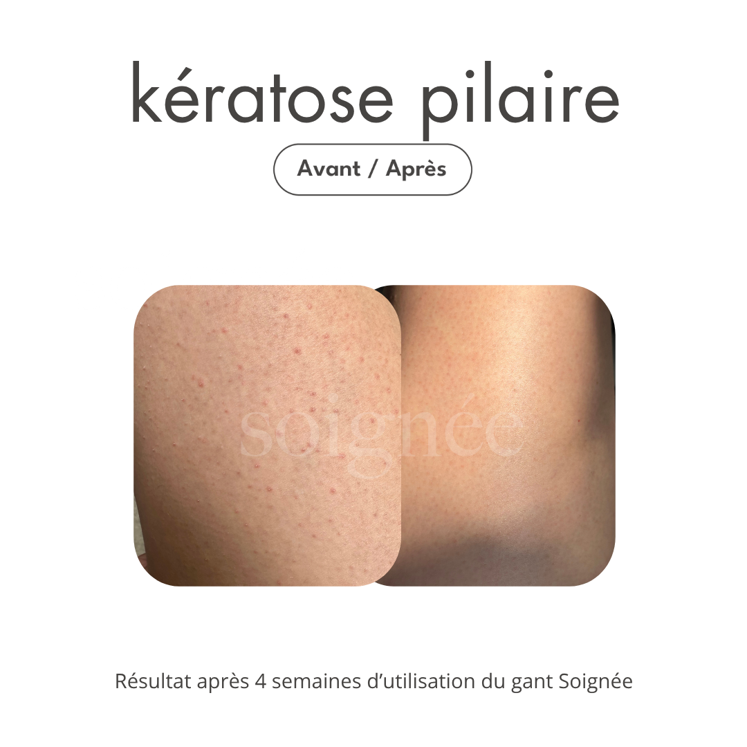 Seconde Chance - Gant Exfoliant en Soie Corps